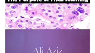The Purpose of H&E Staining | Ali Aziz Quality Education