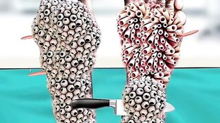 toksin racun dalam tubuh#short