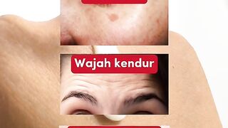 Serum Retinol