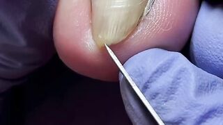 pedicure, Hefei Beicheng Meditation  #pedicure