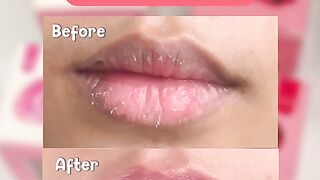 Lip care