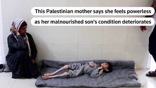 Gazan mother feels powerless to help her malnourished son _ REUTERS.