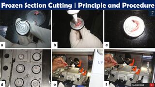 Frozen Section Cutting | Principle and Procedure