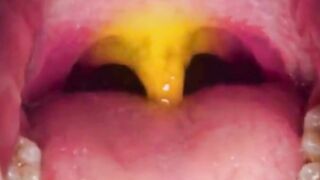 what is that thing under your throat?