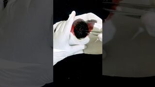 Big Brain Operation ASMR