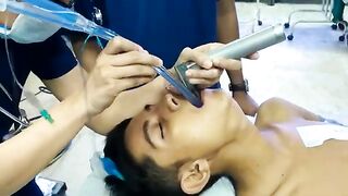 Double_Lumen_endotracheal_tube_insertion.