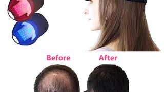 Hair Growth Cap Anti Hair Loss