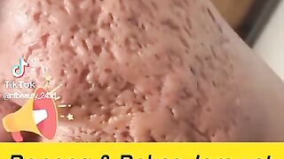 Bedak menghilangkan bekas jerawat
