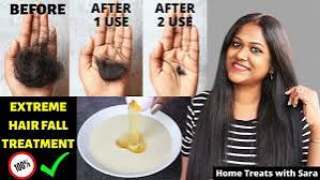 Stop hair fall within 30 days - Best remedy
