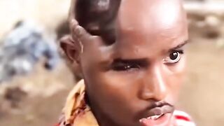 His brain head to be remove