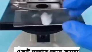 হস্থমেথুন না অবৈধ শারীরিক সম্পর্কের ফলে,,  অবশ্যই দেখবেন