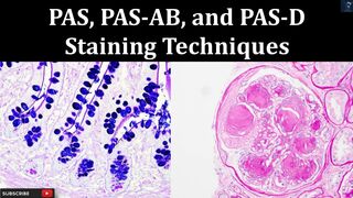 PAS, PAS AB, and PAS D Staining Techniques , Principal, Procedure #histopathology #laboratory