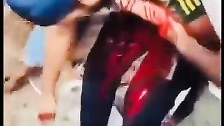 বাংলাদেশের কোটা আনদোলনে ছাএের রক্ত ????????
