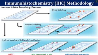 Immunohistochemistry (IHC) Methodology | Principle and Key Steps in (IHC) Methodology