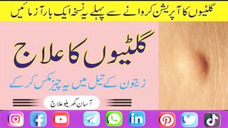 Zatoon Ke Tail Se Gutiyo Ka Ilaj l Zatoon Ke Tail Ke Fayde l Urdu Quotes