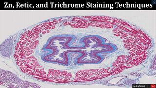 Zn, Retic, and Trichrome Staining Techniques | Pathology Expert Lab Guide