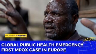 Global Public Health Emergency: First Mpox Case in Europe