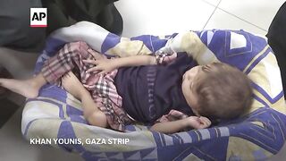 11 young cancer patients evacuated from Gaza for medical treatment in Jordan