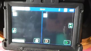 Fujikura 88s+ operation error