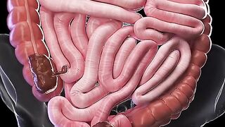 Constipation - 3d animation _meded _anatomy _3dmodel(720P_HD).