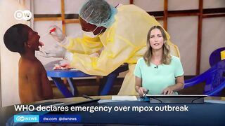 Mpox virus.new bio weapon from WHO