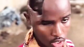 This Guy Lives Without a Brain????