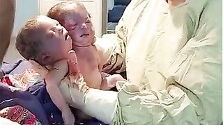 A child with two heads and a tail
