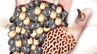 ASMR menghilangkan kutu & belatung dari Tangan | pengobatan luka parah