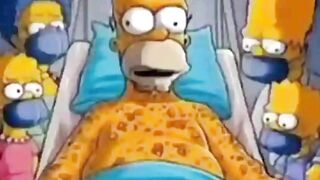 Apakah ini sungguhan ?. The Simpsons Memprediksi Monkeypox. The Simpsons Predict Monkeypox