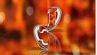 Vedio 22