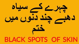 BLACK SPOTS OF  FACE- چہرے کے سیاہ  داغ  دھبے