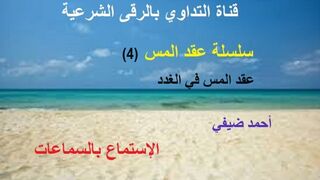 عقد المس في الغدد