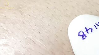 Blackheads Removal | Acne Treatment and Very Satisfying Satisfying Pimple pop #blackheads