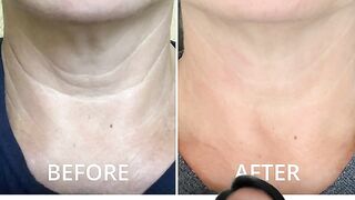 gopure neck  https://bit.ly/3U6KVP2