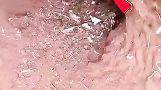 A ranger discovered baby owls under the tree and then... #shorts