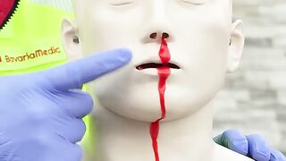 First Aid for Nosebleeds ???????? _ambulance _firstaid _paramedic _hospital _emergency _nurse