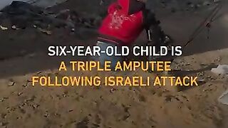 A six-year-old Palestinian child is a triple amputee following the Israeli offensive on Gaza.