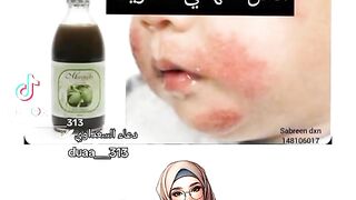 شركة dxn