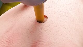 How An Anchor Piercing Works ????