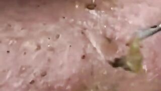 SPA ASMR???? Series 1, Episode 1 part 14