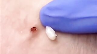 SPA ASMR???? Series 1, Episode 1 part 21