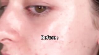 Best facemask ???? for teens
