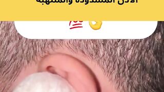 The ancient and miraculous method for treating blocked and inflamed ears