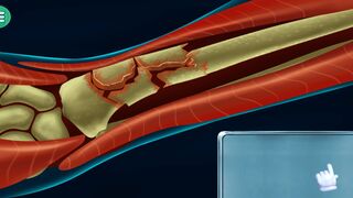 ASMR Hand Surgery Medical Game: A Fun and Educational Way to Learn About Hand Surgery || Get a Taste of Real Hand Surgery with ASMR Medical Game