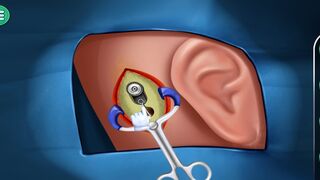 ASMR Ear Surgery Medical Game: The Perfect Way to Learn Surgery Skills || ASMR Ear Surgery Medical Game: The Ultimate Training Tool for Surgeons
