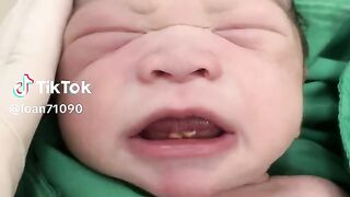 Strange baby