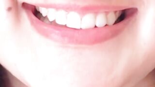 Teeth whitening gel