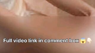 Tummy Tear Video Viral Video Original