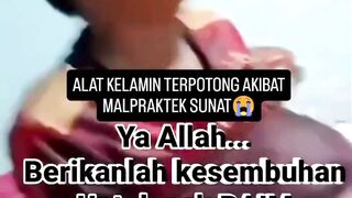 Tragis! Bocah 10 tahun di Kerinci alami malapraktik sunat laser