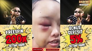 Seorang gadis yatim piatu berinisial VW (18) dianiaya tantenya